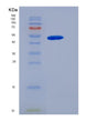 SDS-PAGE analysis of Human MMP8 (Neutrophil Collagenase) - Recombinant Protein, showing >90% purity under 15% SDS-PAGE (Reduced)