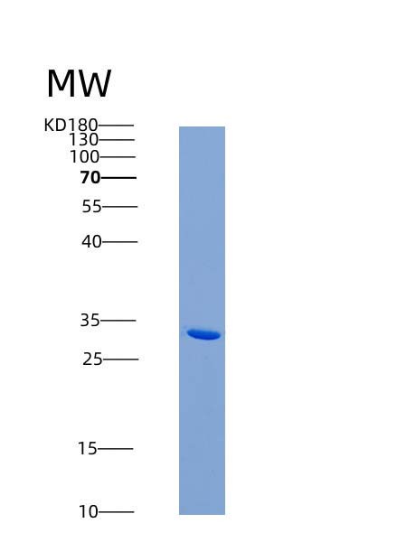 SDS-PAGE analysis of Human FCN1 (Ficolin-1) - Recombinant Protein, showing >90% purity under 15% SDS-PAGE (Reduced)