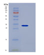 SDS-PAGE analysis of Mouse Tnfrsf17 (Tumor Necrosis Factor Receptor Superfamily Member 17) - Recombinant Protein, showing >90% purity under 15% SDS-PAGE (Reduced)