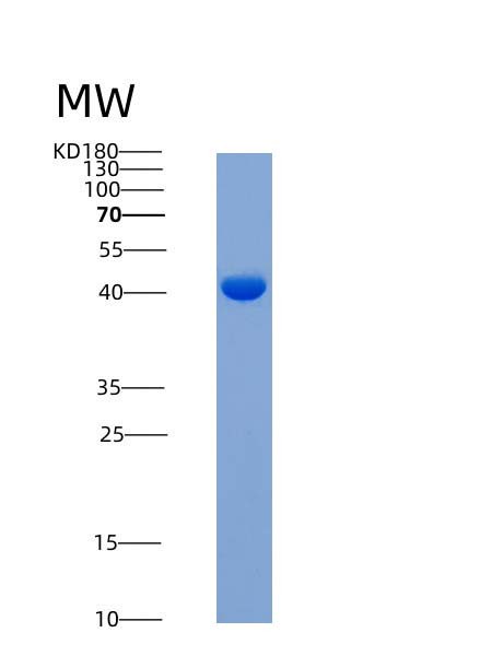 SDS-PAGE analysis of Human IL1RAPL2 (X-Linked Interleukin-1 Receptor Accessory Protein-Like 2) - Recombinant Protein, showing >85% purity under 15% SDS-PAGE (Reduced)