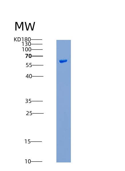 SDS-PAGE analysis of Human MAP3K8 (Mitogen-Activated Protein Kinase Kinase Kinase 8) - Recombinant Protein, showing >90% purity under 15% SDS-PAGE (Reduced)