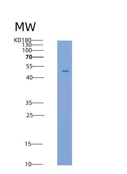 SDS-PAGE analysis of Mouse Cd80 (T-Lymphocyte Activation Antigen Cd80) - Recombinant Protein, CAT# BLT-08437P showing >95% purity under 15% SDS-PAGE (Reduced)