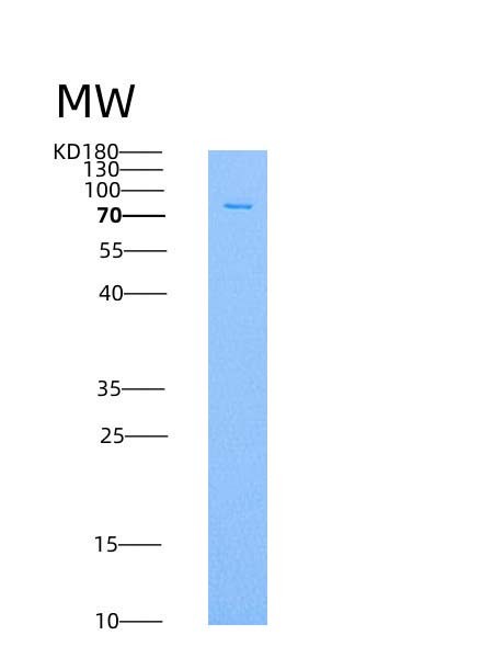 SDS-PAGE analysis of Human EPHA4 (Ephrin Type-A Receptor 4) - Recombinant Protein, showing >90% purity under 15% SDS-PAGE (Reduced)