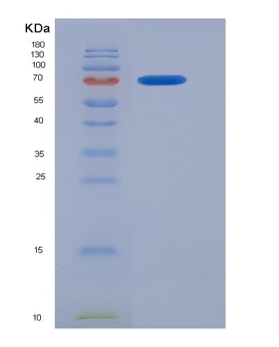 SDS-PAGE analysis of Human FGFR1 (Fibroblast Growth Factor Receptor 1) - Recombinant Protein, showing >85% purity under 15% SDS-PAGE (Reduced)
