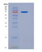 SDS-PAGE analysis of Human FGFR1 (Fibroblast Growth Factor Receptor 1) - Recombinant Protein, showing >85% purity under 15% SDS-PAGE (Reduced)