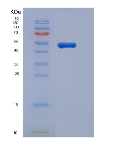 SDS-PAGE analysis of Mouse Ghrhr (Growth Hormone-Releasing Hormone Receptor) - Recombinant Protein, showing >95% purity under 15% SDS-PAGE (Reduced)