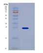 SDS-PAGE analysis of Human FCGR3A (Low Affinity Immunoglobulin Gamma Fc Region Receptor Iii-A) - Recombinant Protein, showing >85% purity under 15% SDS-PAGE (Reduced)