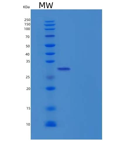 SDS-PAGE analysis of Human VSIG4 (V-Set And Immunoglobulin Domain-Containing Protein 4) - Recombinant Protein, showing >95% purity under 15% SDS-PAGE (Reduced)