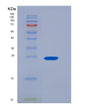 SDS-PAGE analysis of Human FCGR3A (Low Affinity Immunoglobulin Gamma Fc Region Receptor Iii-A) - Recombinant Protein, showing >95% purity under 15% SDS-PAGE (Reduced)