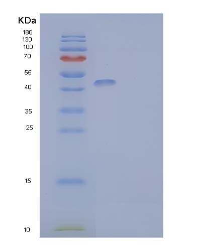 SDS-PAGE analysis of Human LY9 (T-Lymphocyte Surface Antigen Ly-9) - Recombinant Protein, showing >95% purity under 15% SDS-PAGE (Reduced)