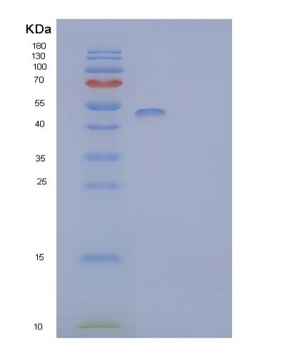 SDS-PAGE analysis of Human IL2RA (Interleukin-2 Receptor Subunit Alpha) - Recombinant Protein, showing >95% purity under 15% SDS-PAGE (Reduced)