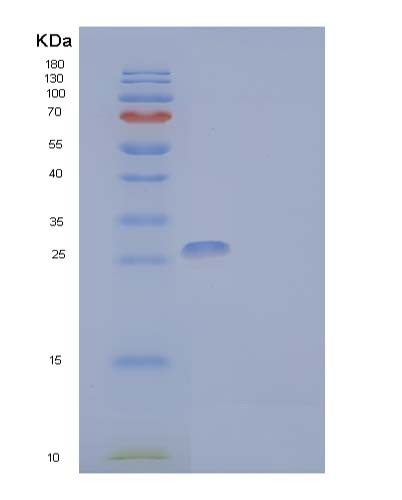 SDS-PAGE analysis of Human IL2RG (Cytokine Receptor Common Subunit Gamma) - Recombinant Protein, showing >95% purity under 15% SDS-PAGE (Reduced)