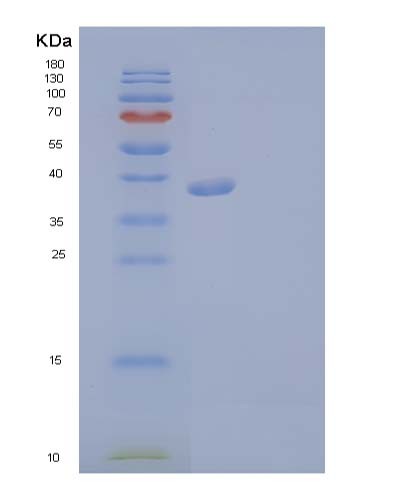SDS-PAGE analysis of Human FGFR3 (Fibroblast Growth Factor Receptor 3) - Recombinant Protein, showing >90% purity under 15% SDS-PAGE (Reduced)
