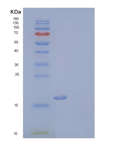 SDS-PAGE analysis of Human TREM2 (Triggering Receptor Expressed On Myeloid Cells 2) - Recombinant Protein, showing >85% purity under 15% SDS-PAGE (Reduced)