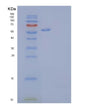 SDS-PAGE analysis of Human EPHA4 (Ephrin Type-A Receptor 4) - Recombinant Protein, showing >95% purity under 15% SDS-PAGE (Reduced)