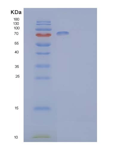 SDS-PAGE analysis of Human EPHB2 (Ephrin Type-B Receptor 2) - Recombinant Protein, showing >85% purity under 15% SDS-PAGE (Reduced)