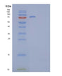 SDS-PAGE analysis of Human EPHB2 (Ephrin Type-B Receptor 2) - Recombinant Protein, showing >85% purity under 15% SDS-PAGE (Reduced)