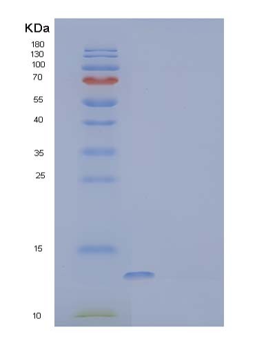 SDS-PAGE analysis of Human SECTM1 (Secreted And Transmembrane Protein 1) - Recombinant Protein, showing >85% purity under 15% SDS-PAGE (Reduced)