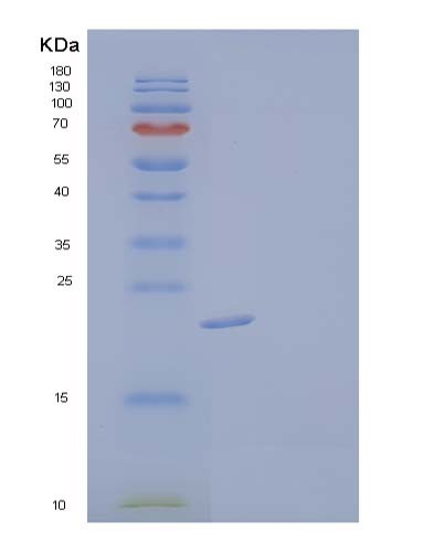 SDS-PAGE analysis of Human PRL (Prolactin) - Recombinant Protein, showing >95% purity under 15% SDS-PAGE (Reduced)
