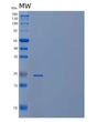 SDS-PAGE analysis of Human CCDC134 (Coiled-Coil Domain-Containing Protein 134) - Recombinant Protein, showing >90% purity under 15% SDS-PAGE (Reduced)