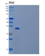 SDS-PAGE analysis of Human PPT1 (Palmitoyl-Protein Thioesterase 1) - Recombinant Protein, showing >95% purity under 15% SDS-PAGE (Reduced)