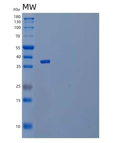 SDS-PAGE analysis of Mouse Il1r2 (Interleukin-1 Receptor Type 2) - Recombinant Protein, showing >85% purity under 15% SDS-PAGE (Reduced)