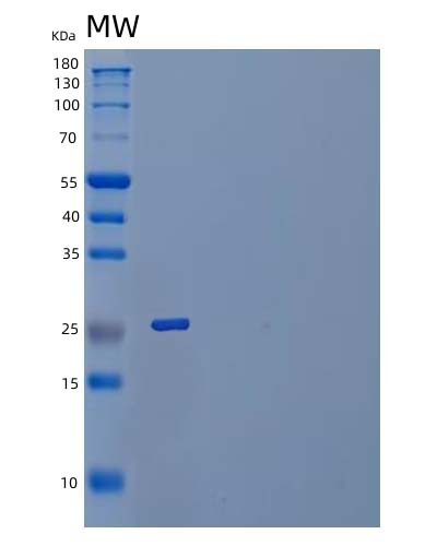 SDS-PAGE analysis of Human IL20RA (Interleukin-20 Receptor Subunit Alpha) - Recombinant Protein, showing >90% purity under 15% SDS-PAGE (Reduced)