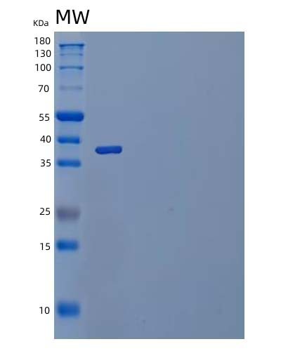SDS-PAGE analysis of Human IL23R (Interleukin-23 Receptor) - Recombinant Protein, showing >90% purity under 15% SDS-PAGE (Reduced)