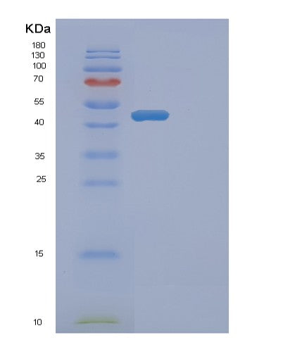 SDS-PAGE analysis of Human ETNK2 (Ethanolamine Kinase 2) - Recombinant Protein, showing >90% purity under 15% SDS-PAGE (Reduced)