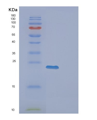 SDS-PAGE analysis of Human EXOSC1 (Exosome Complex Component Csl4) - Recombinant Protein, showing >95% purity under 15% SDS-PAGE (Reduced)