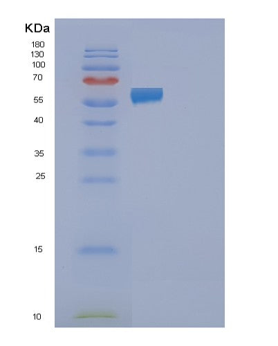 SDS-PAGE analysis of Human FAAH2 (Fatty-Acid Amide Hydrolase 2) - Recombinant Protein, showing >85% purity under 15% SDS-PAGE (Reduced)