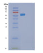 SDS-PAGE analysis of Human FAAH2 (Fatty-Acid Amide Hydrolase 2) - Recombinant Protein, showing >85% purity under 15% SDS-PAGE (Reduced)