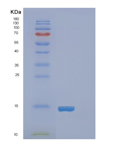 SDS-PAGE analysis of Human FABP4 (Fatty Acid-Binding Protein, Adipocyte) - Recombinant Protein, showing >85% purity under 15% SDS-PAGE (Reduced)