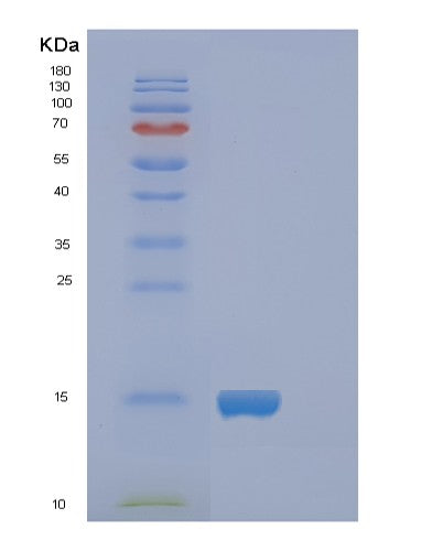 SDS-PAGE analysis of Human FABP5 (Fatty Acid-Binding Protein 5) - Recombinant Protein, showing >95% purity under 15% SDS-PAGE (Reduced)