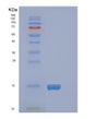 SDS-PAGE analysis of Human FABP5 (Fatty Acid-Binding Protein 5) - Recombinant Protein, showing >95% purity under 15% SDS-PAGE (Reduced)