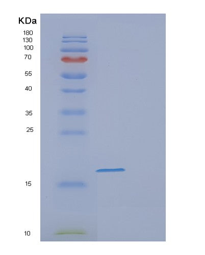SDS-PAGE analysis of Human FABP9 (Fatty Acid-Binding Protein 9) - Recombinant Protein, showing >95% purity under 15% SDS-PAGE (Reduced)