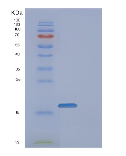 SDS-PAGE analysis of Human FAM107B (Protein Fam107B) - Recombinant Protein, showing >85% purity under 15% SDS-PAGE (Reduced)