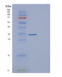 SDS-PAGE analysis of Human LRATD1 (Protein Lratd1) - Recombinant Protein, showing >95% purity under 15% SDS-PAGE (Reduced)