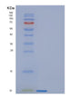 SDS-PAGE analysis of Human FANK1 (Fibronectin Type 3 And Ankyrin Repeat Domains Protein 1) - Recombinant Protein, showing >85% purity under 15% SDS-PAGE (Reduced)
