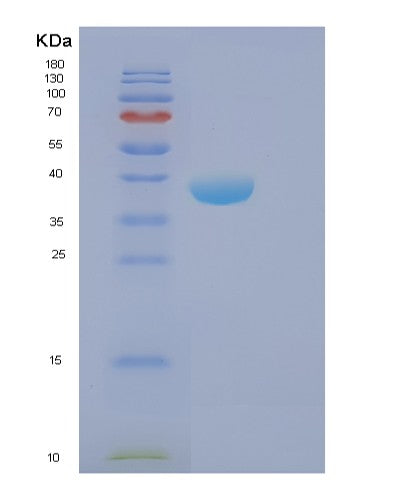 SDS-PAGE analysis of Human FBP2 (Fructose-1,6-Bisphosphatase Isozyme 2) - Recombinant Protein, showing >90% purity under 15% SDS-PAGE (Reduced)