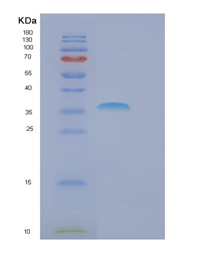 SDS-PAGE analysis of Human FBXO6 (F-Box Only Protein 6) - Recombinant Protein, showing >95% purity under 15% SDS-PAGE (Reduced)
