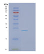 SDS-PAGE analysis of Human FCER1A (High Affinity Immunoglobulin Epsilon Receptor Subunit Alpha) - Recombinant Protein, showing >90% purity under 15% SDS-PAGE (Reduced)
