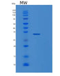 SDS-PAGE analysis of Human FCGR1A (High Affinity Immunoglobulin Gamma Fc Receptor I) - Recombinant Protein, showing >85% purity under 15% SDS-PAGE (Reduced)