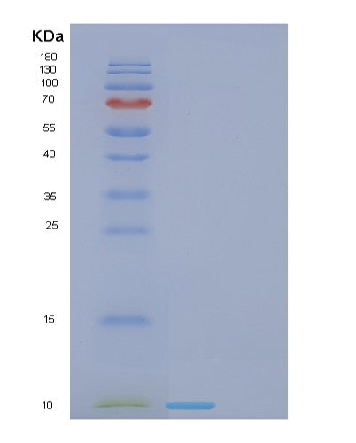 SDS-PAGE analysis of Human FDCSP (Follicular Dendritic Cell Secreted Peptide) - Recombinant Protein, showing >85% purity under 15% SDS-PAGE (Reduced)