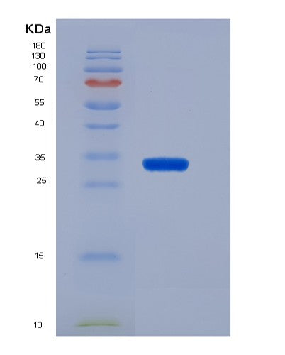 SDS-PAGE analysis of Human CD19 (B-Lymphocyte Antigen Cd19) - Recombinant Protein, showing >95% purity under 15% SDS-PAGE (Reduced)