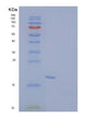 SDS-PAGE analysis of Human VAPB (Vesicle-Associated Membrane Protein-Associated Protein B/C) - Recombinant Protein, showing >85% purity under 15% SDS-PAGE (Reduced)