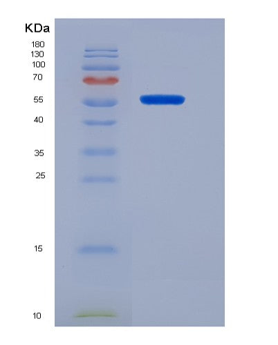 SDS-PAGE analysis of Human CD19 (B-Lymphocyte Antigen Cd19) - Recombinant Protein, showing >95% purity under 15% SDS-PAGE (Reduced)