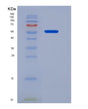 SDS-PAGE analysis of Human CD19 (B-Lymphocyte Antigen Cd19) - Recombinant Protein, showing >95% purity under 15% SDS-PAGE (Reduced)