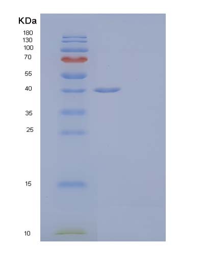SDS-PAGE analysis of Human ALDOC (Fructose-Bisphosphate Aldolase C) - Recombinant Protein, showing >90% purity under 15% SDS-PAGE (Reduced)