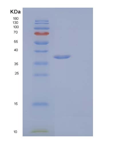 SDS-PAGE analysis of Human IL1R1 (Interleukin-1 Receptor Type 1) - Recombinant Protein, showing >95% purity under 15% SDS-PAGE (Reduced)